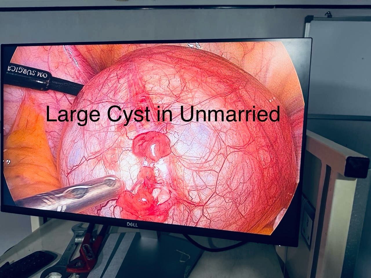 A laparoscopic surgeon patients trust with difficult